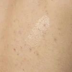 Salicylic Acid 0.5% Body Serum - Image 4